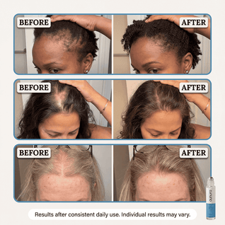 Hair Growth Boosting Serum